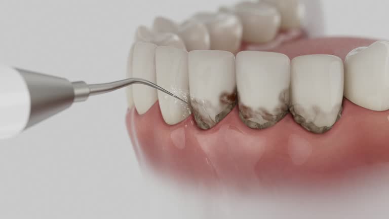 Trusted Teeth Cleaning And Checkup service in St. Joseph, MO - Dentist Open Now